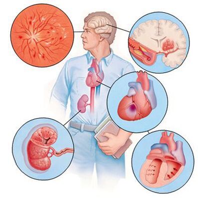 Cardiol hoiab ära kaasuvate haiguste teket